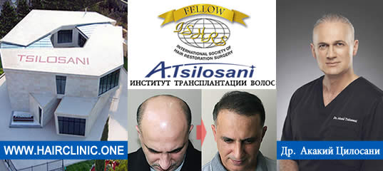 Восстановление бороды - до и после. Проф. Акакий Цилосани