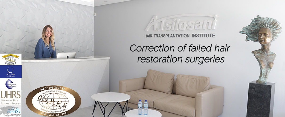 REVISION OF THE UNFAVORABLE RESULTS IN HAIR TRANSPLANTATION