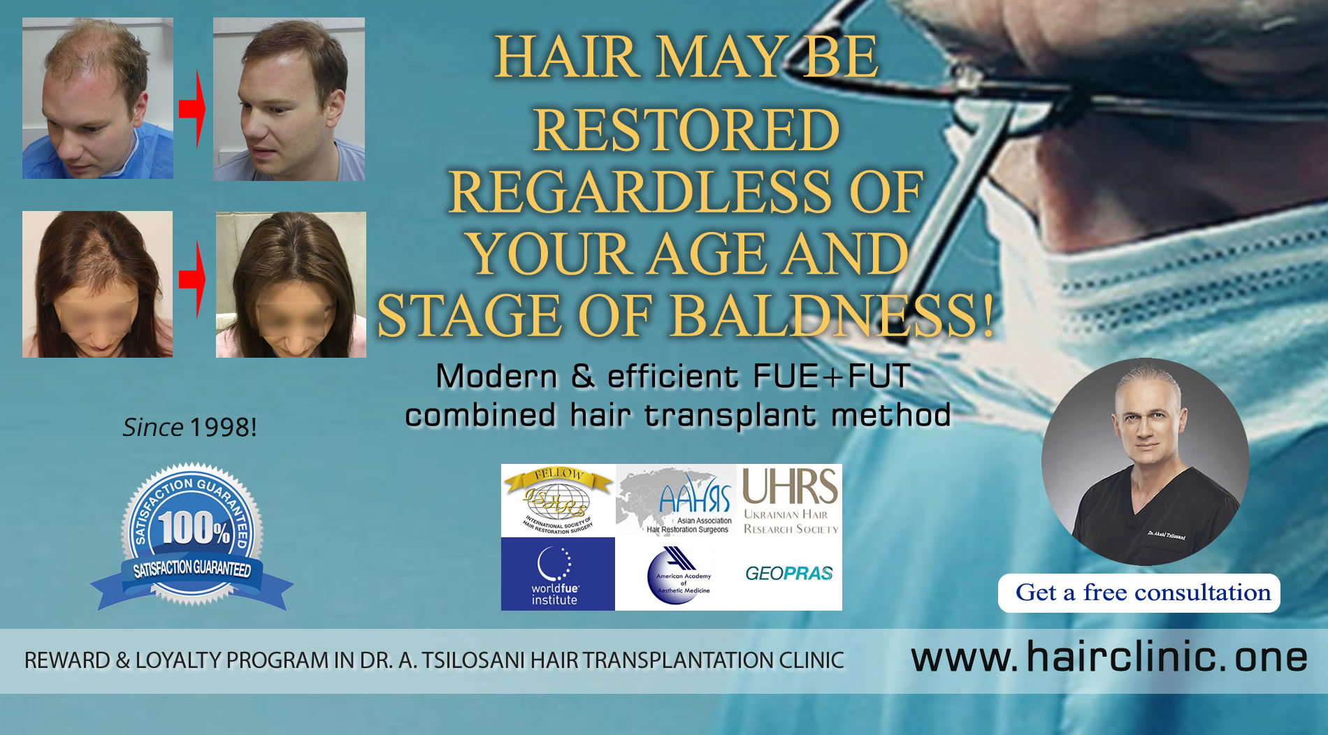 FUE Hair Transplant - Before & after. Dr Akaki Tsilosani, MD, PhD, FISHRS